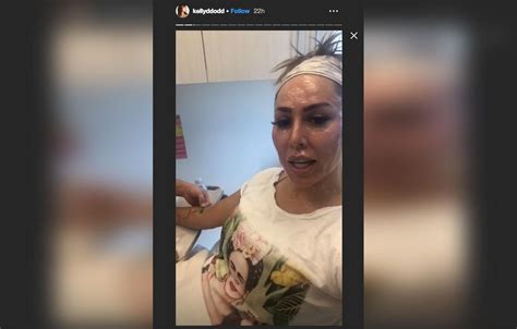 'RHOC’ Star Kelly Dodd Goes In For Another Cosmetic Procedure In Instagram Story