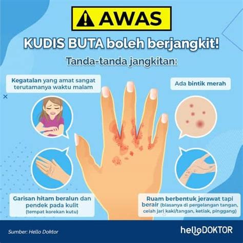 Cara Rawat Kudis Buta: Bahan Semula Jadi Berikut Mungkin Boleh Bantu!