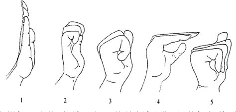 Figure 2 from Ultrasonographic median nerve changes under tendon ...