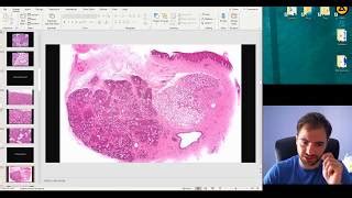 Histology of the Digestive Glands part 1 ( Structure of... | Doovi