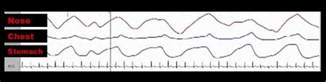 What is a CPAP titration study?