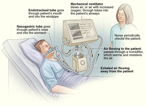 Respiratory Therapy Cave: What is a ventilator?