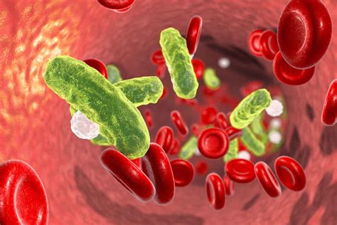 Bacteremia definition, causes, symptoms, diagnosis, treatment & prognosis