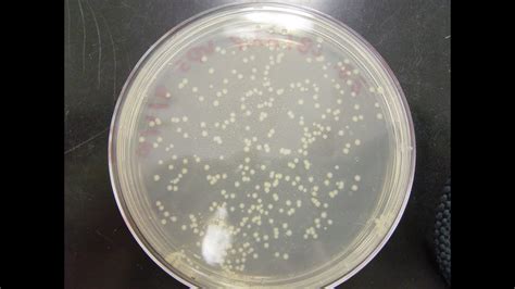 Colony Forming Unit Calculation : a3 | Colony Forming Unit | Bacteria ...