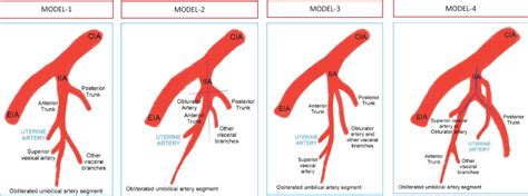 From Where Does the Uterine Artery Originate? A Prospective, Observational Laparoscopic Anatomic ...