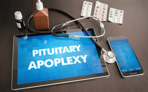 Unpacking the 10 Symptoms of Pituitary Apoplexy: An In-depth Exploration