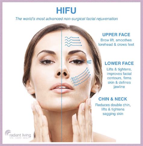 HIFU Face Lift - Radiant Living