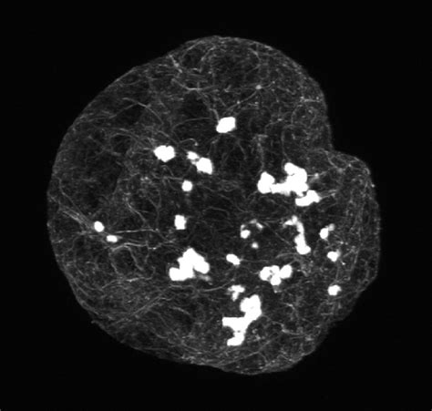 Confocal image of a tobacco BY-2 cell protoplast, 20 h after infection... | Download Scientific ...