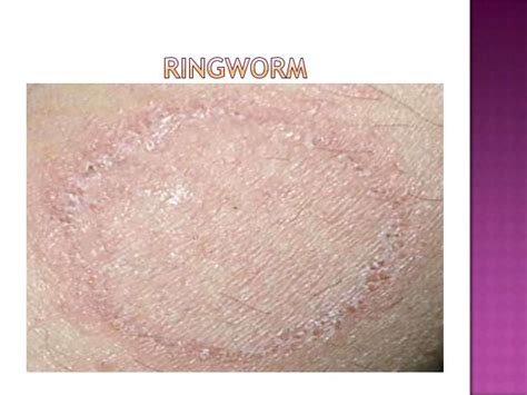 most common skin diseases - pictures, photos