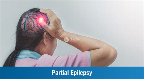 Partial seizures - PLEXUS