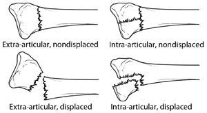 Practitioner to Patient. Part 2. | Headwaters Physiotherapy