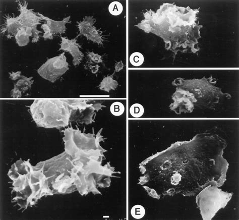 Scanning electron microscope micrographs of wild-type Dictyostelium ...