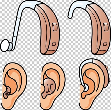 Hearing Aid Hearing Loss PNG, Clipart, Aids, Audiology, Cartoon ...