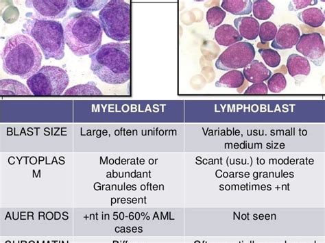 Lymphoblast Vs Myeloblast