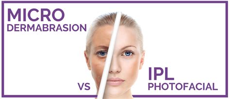 Microdermabrasion vs IPL Photofacial: What's the difference? | Eureka Body Care & Spa