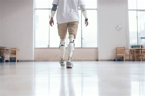 Man Walking Confidently with Advanced Prosthetic Leg Technology. GenerativeAI Stock Image ...