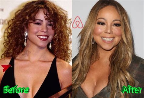 Mariah Carey Plastic Surgery: Has Mariah Found A Youth Fountain?