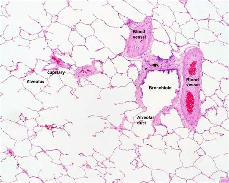 lung histology labeled - bronchiole, alveolar duct, alveoli | lab practical pics | Pinterest | Lungs