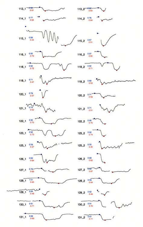 Sparkline theory and practice Edward Tufte | Information visualization, Edward tufte, Data ...