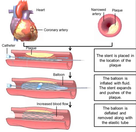 Healthy wealth: DARD - E - DIL -- The Broken Heart