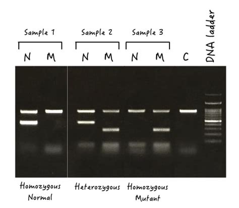 7 Ways to Determine Genotypes Using Gel Electrophoresis – Genetic Education