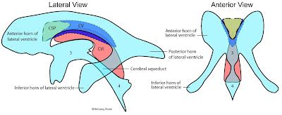 Radiology MRI: Cavum Velum Interpositum on MRI