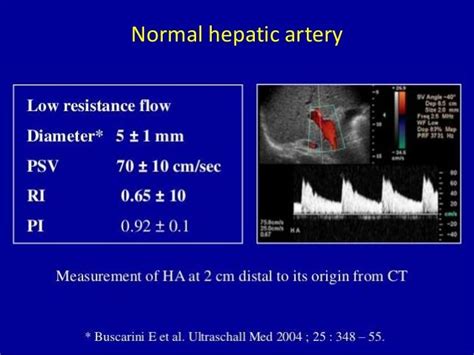 Hepatic Artery - Normal Findings. | Medical ultrasound, Ultrasound humor, Ultrasound