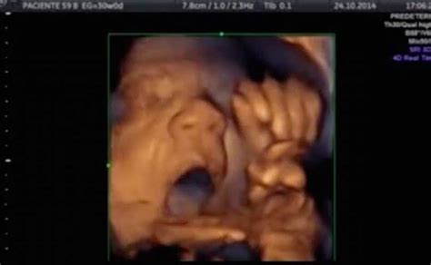 The Good News Today – Video Shows Unborn Baby at 18 Weeks ‘Singing’ to Music in Groundbreaking Study