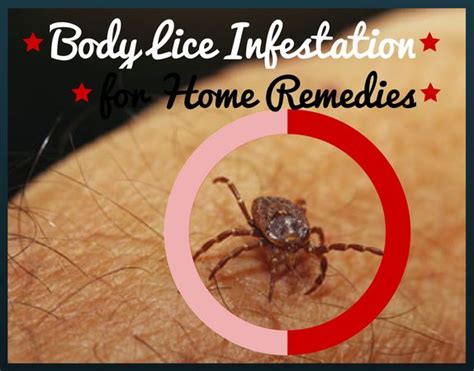 11 Home Remedies for Body Lice Infestation | Skin care home remedies ...