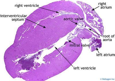 Heart (labels) - histology slide This is a histology slide of the heart. Histology Slides ...