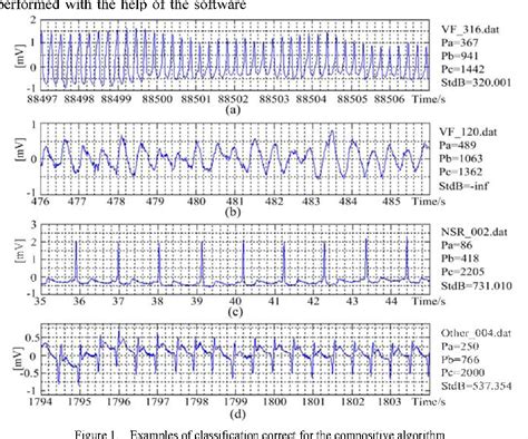 Figure 2 from A shockable rhythm detection algorithm for automatic ...