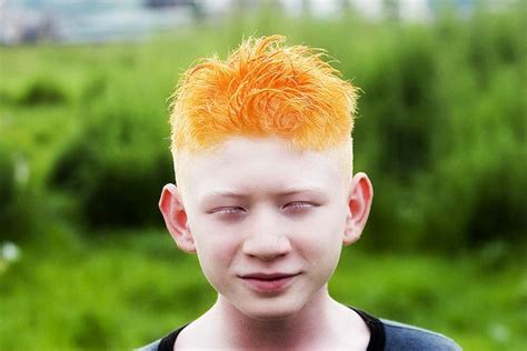 Albino boy with orange hair in Kathmandu, Nepal. Photographer: Leonard van Bruggen IV | Human ...