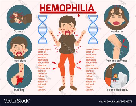 Hemophilia symptom infographics elements sign Vector Image