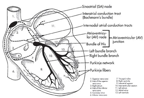 What is Heart Arrhythmia - Symptoms, Causes, Treatment