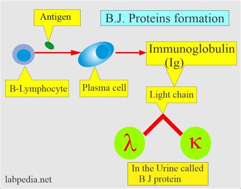 Bence-Jones Proteinuria and Multiple Myeloma - Labpedia.net