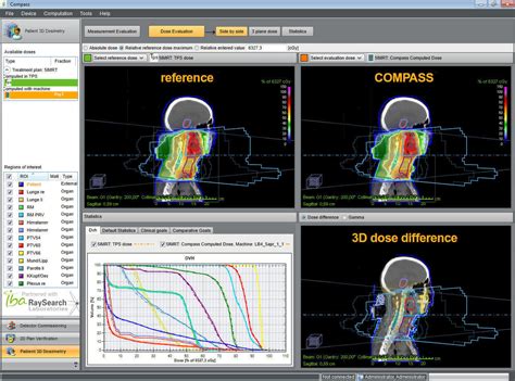 IBA Dosimetry: COMPASS