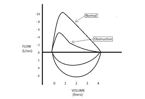 Top 5 Spirometry Tips for COPD Diagnosis and Management | Respiratory Therapy