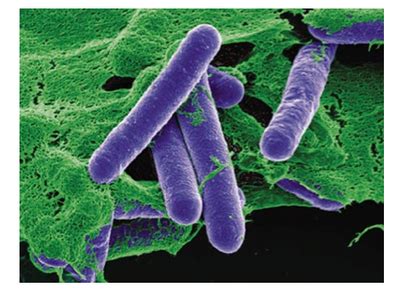 Opiniones de Clostridium botulinum