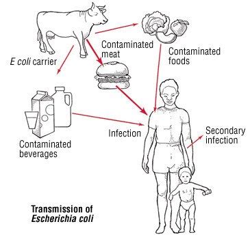 Food Poisoning Guide: Causes, Symptoms and Treatment Options