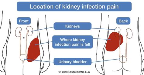 Pin on Patient Education: Medical knowledge for all