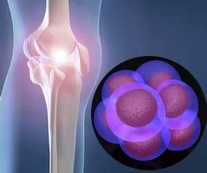 Are Stem Cells An Alternative to Total Knee Replacement?