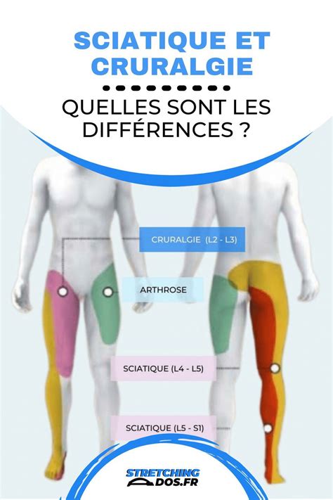 Sciatique et cruralgie : quelles sont les différences ? - StretchingDos.fr | Sciatique ...