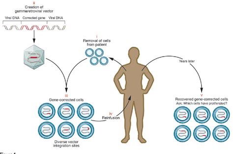 Figure 1 from Retroviral integration and human gene therapy. | Semantic Scholar