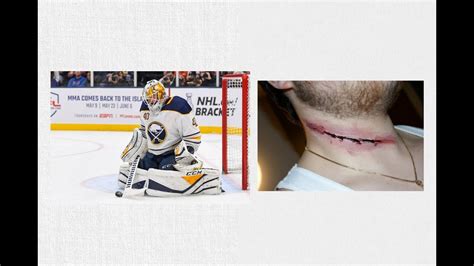 Clint Malarchuk Scar