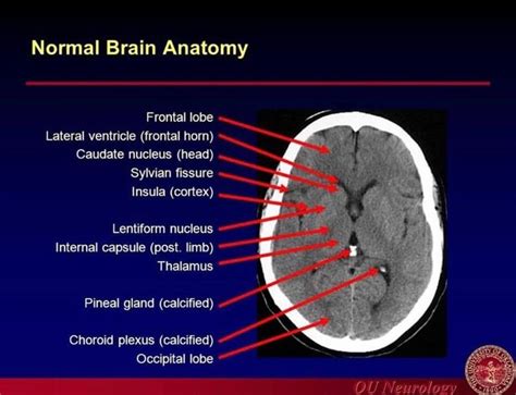 Pin by Andres Sanchez on Radiology | Brain anatomy, Radiology imaging, Anatomy