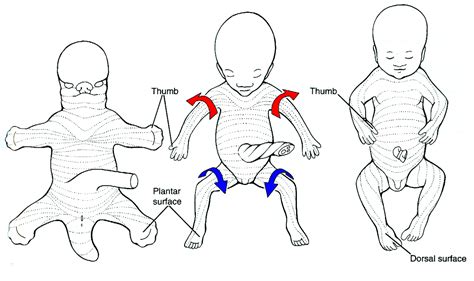 lateral and medial rotation of limb buds | Limb, Pediatrics, Bud