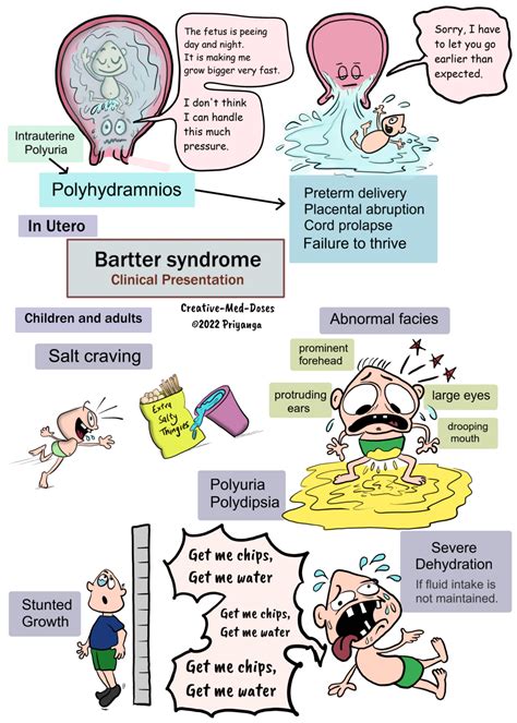 Bartter syndrome - Creative Med Doses