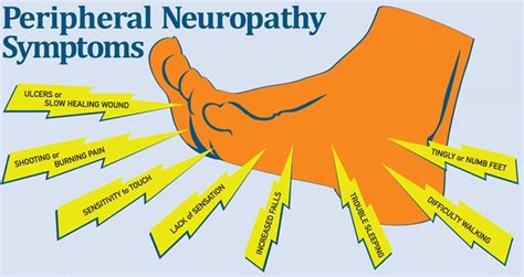 FSM relieves peripheral neuropathy - Frequency Specific Microcurrent