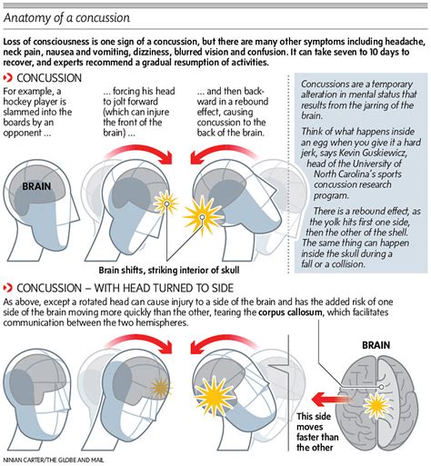 Loss of vision symptoms: Symptoms, Signs, Causes & Treatment