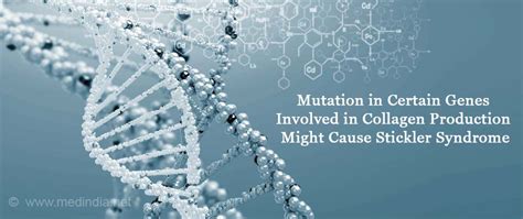 Stickler Syndrome - Causes, Symptoms, Diagnosis, Treatment & Prevention